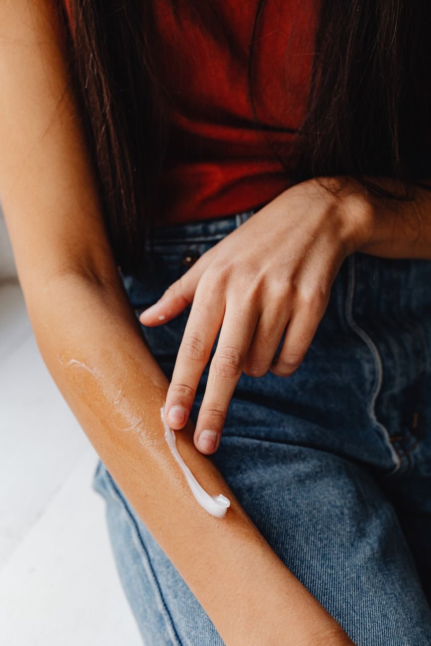 Person applying medicated cream to their arm for insect bite relief